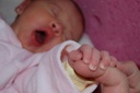 Proposta detecção de síndrome de Down em recém-nascidos